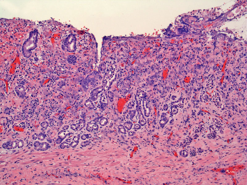 Path Image